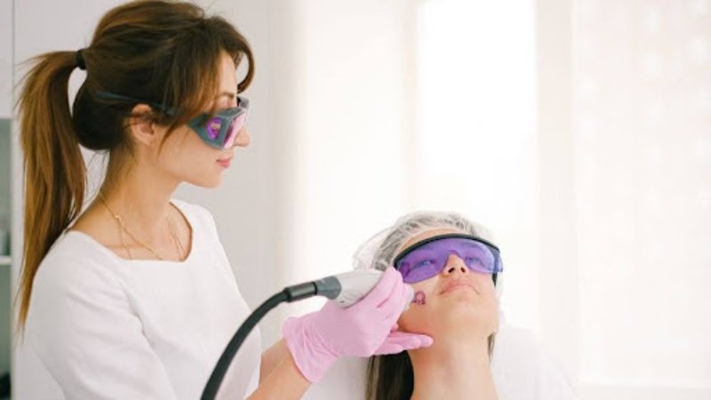 Before Choosing Laser Skin Resurfacing